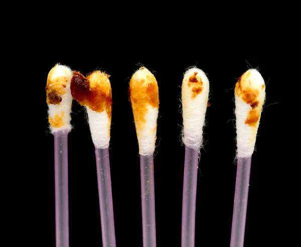 Ear Wax Een Wattenstaafje Cerumen — Stockfoto