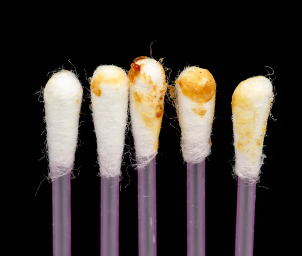 Ear wax on a cotton swab, cerumen