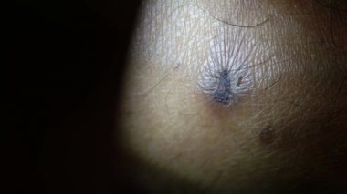 kıllı bir deri yakın çekim