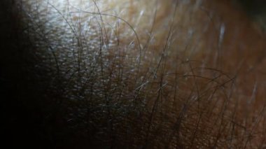 Yaralı cilt dokusunu görüntüleri kapat 