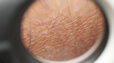 kıllı bir deri yakın çekim