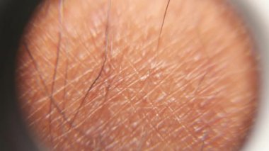 kıllı bir deri yakın çekim