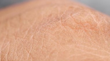 kıllı bir deri yakın çekim