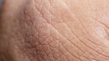 kıllı bir deri yakın çekim