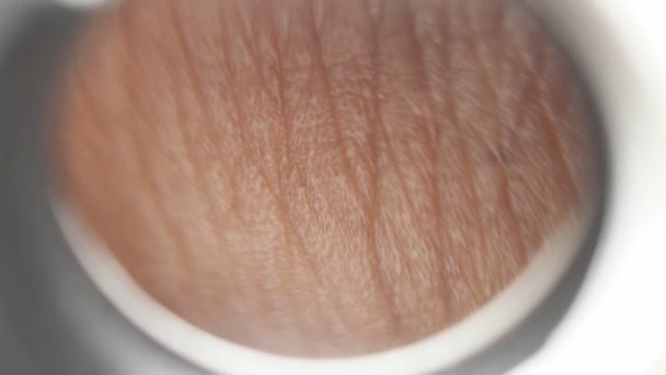 Close Hairy Skin — Stock Video