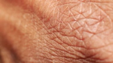 kıllı bir deri yakın çekim