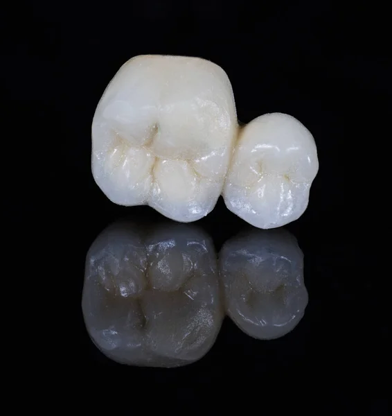 Κεραμική Οδοντωτή Κορώνα Μαύρο Φόντο — Φωτογραφία Αρχείου