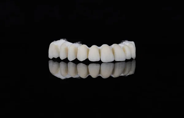 Dentes Cerâmica Modelo Coroas Dentárias Fundo Preto Vista Frontal — Fotografia de Stock