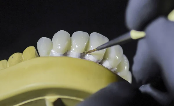 Зубной Техник Нанес Глазурь Керамическую Корону Стоматолог Работающий Инструментом — стоковое фото