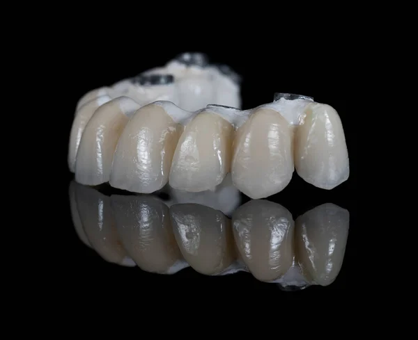 Dentes Cerâmica Modelo Coroas Dentárias Fundo Preto — Fotografia de Stock