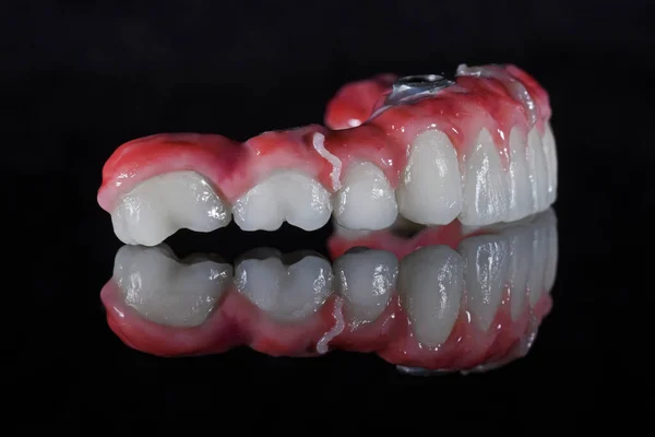 Δεξιά Πλευρά Του Κάτω Μέρους Τεχνητό Σαγόνι Δόντια Μαύρο Φόντο — Φωτογραφία Αρχείου