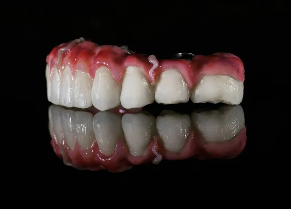 Lado Direito Parte Inferior Mandíbula Artificial Com Dentes Fundo Preto — Fotografia de Stock