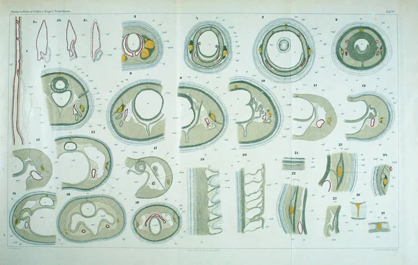 Structuur Anatomie Van Wormen Nemertea — Stockfoto