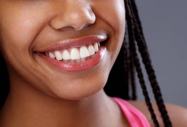 El primer plano de los dientes blancos en la mujer sonriente — Foto de Stock