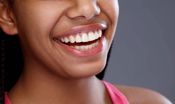 Primo piano del sorriso con denti bianchi perfetti, primo piano — Foto Stock