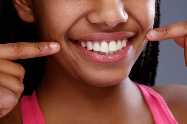 Afrikaanse vrouw wijzend naar haar tanden, close-up — Stockfoto