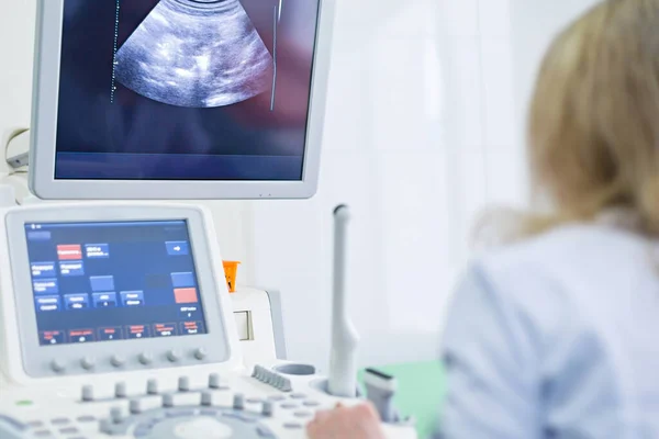 Doctor Examines Patient Computer Ultrasound Machine — Stock Photo, Image