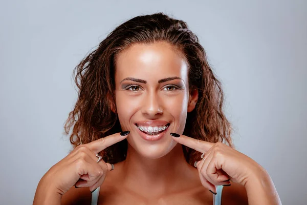 Uśmiechnięta Młoda Kobieta Pokazując Doskonałe Białe Zęby Szelkami — Zdjęcie stockowe