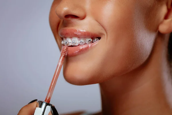 Senyum Wanita Muda Dengan Kawat Gigi Menerapkan Lip Gloss Bibir — Stok Foto