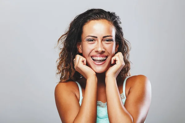 Portret Van Jonge Vrouw Weergegeven Perfecte Witte Tanden Met Accolades — Stockfoto