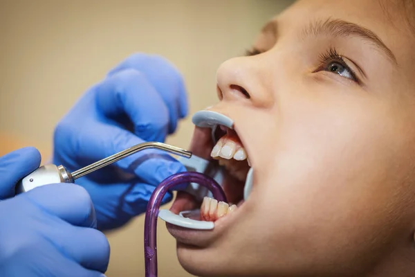 Adolescente Está Dentista Sienta Silla Del Dentista Dentista Prepara Los —  Fotos de Stock