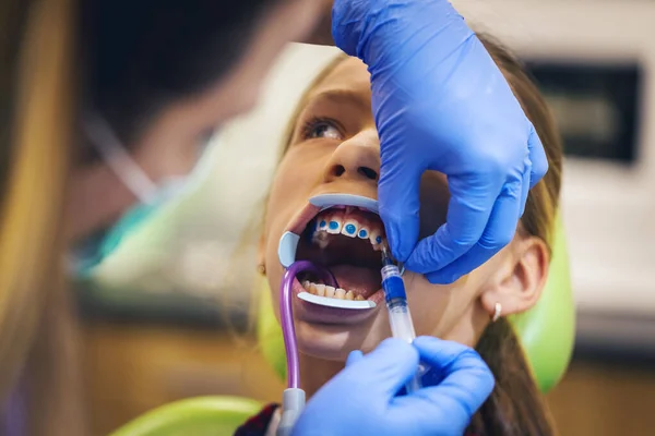 Dziewczynka Jest Dentysty Siedzi Fotelu Dentystycznym Dentysta Zakłada Aparat Zęby — Zdjęcie stockowe