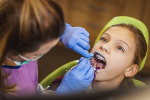 小女孩在牙医那里 她坐在牙医的椅子上 牙医在她的牙齿上套上了牙套 间接粘合在一起 — 图库照片
