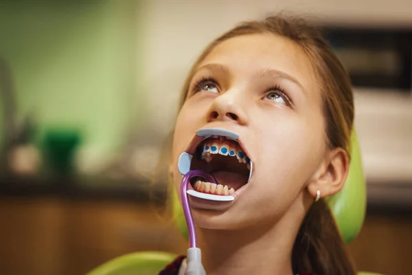 Bambina Dal Dentista Siede Sulla Sedia Del Dentista Dentista Mette — Foto Stock