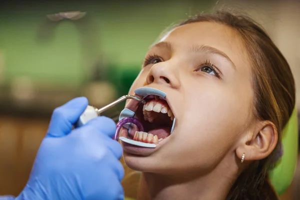 Nastolatka Jest Dentysty Siedzi Fotelu Dentystycznym Dentysta Szykuje Zęby Ustawiania — Zdjęcie stockowe