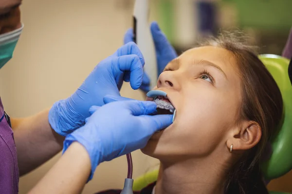 その少女は歯医者にいる 彼女は歯医者の椅子に座って歯医者は歯の上にブレースをセット間接的な結合を入れて — ストック写真