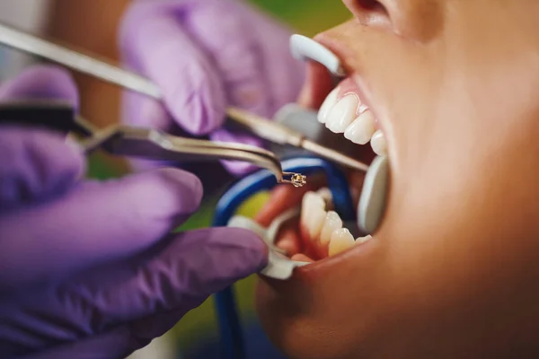 美しい若い女性の切り取られたショットは歯科医にあります 歯医者の椅子に座り歯の上に歯を食いしばり — ストック写真