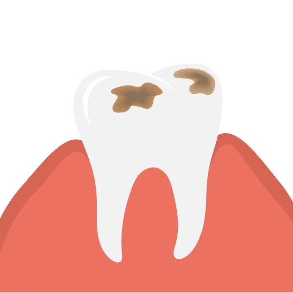 Caries Destruir Los Dientes Diente Apestoso Con Caries Ilustración Vectorial — Archivo Imágenes Vectoriales