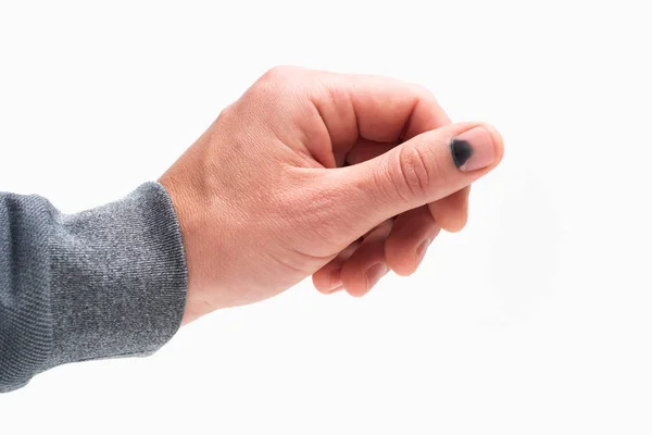 Black Nail Hammer Thumb Pain Hematoma Injury Male Hand Isolated — Stock Photo, Image