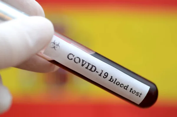 Coronavirus 2019 Ncov Blodprov Epidemiskt Virus Respiratoriskt Syndrom Stock Photo — Stockfoto