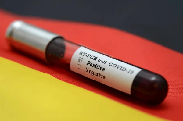 コロナウイルス2019 Ncov血液サンプル 流行性ウイルス呼吸器症候群ストックフォト ドイツでコロナウイルスが発生 血液検査付き検査管のストックフォト 小説コロナウイルス2019疾患 Covid Ncov — ストック写真