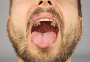 bir sakallı diş muayenesi, closeup için ağzını açtı