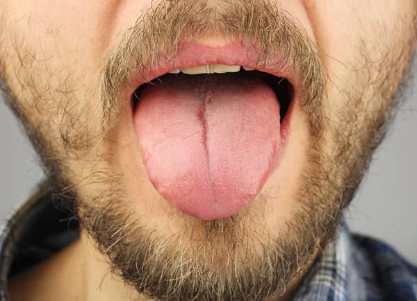 Man Beard Opened His Mouth Stuck Out His Tongue Closeup — Stock Photo, Image