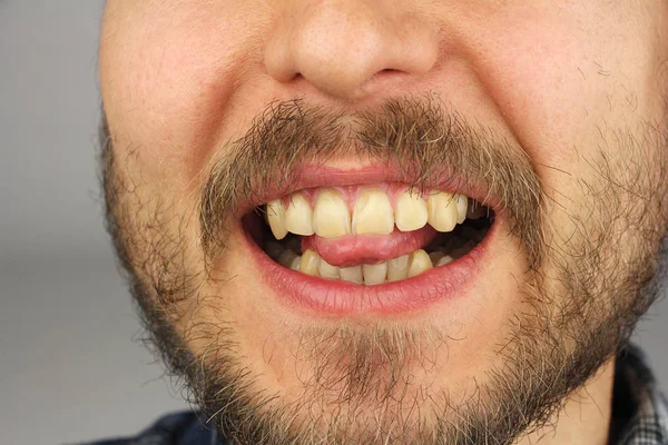 Hombre Con Barba Muerde Punta Lengua Con Los Dientes Primer —  Fotos de Stock