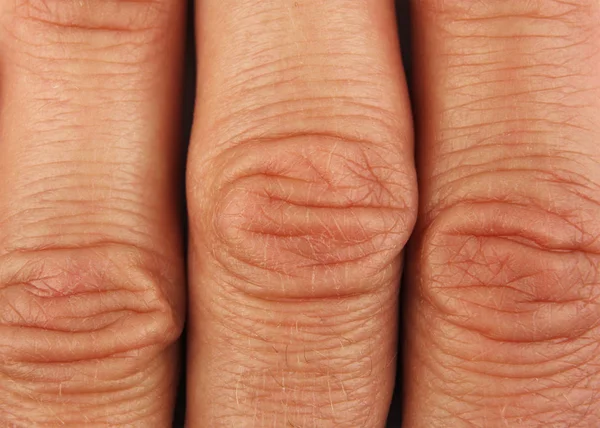 Falten Den Fingergelenken Der Menschlichen Hand Nahaufnahme Makro Draufsicht — Stockfoto