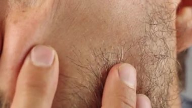 young man runs his fingers along bristling cheek, touches the skin, on the subject of the need to shave face hair, closeup macro   