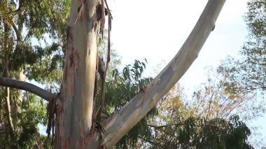 Bir adam dirseğindeki ağrıyı kontrol eder..