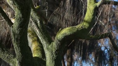 Bir adam dirseğindeki ağrıyı kontrol eder..