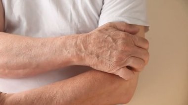 Bir adam kolunda kalıcı bir kaşıntı çizikler
