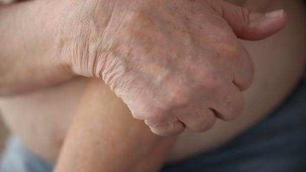 Homme Avec Une Démangeaison Sur Autour Coude — Video