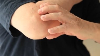 Kıdemli bir adam dirseğinin etrafındaki bölgeyi ovuşturuyor.