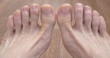 Yetişkin bir adamın ayakları ve ayak parmakları. Adam ayak parmaklarını oynatıyor. Kesilmemiş tırnakları olan güzel erkek ayakları