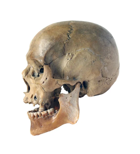 Skull Person White Background — Stock Photo, Image