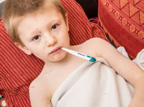 発熱を測定する水痘の子 — ストック写真