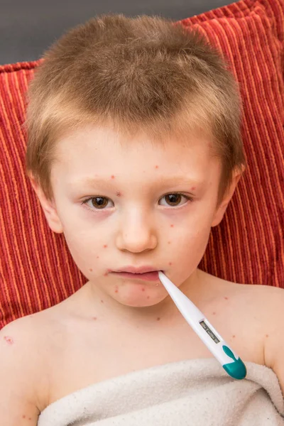 Dziecko Ospy Wietrznej Który Mierzy Gorączka — Zdjęcie stockowe