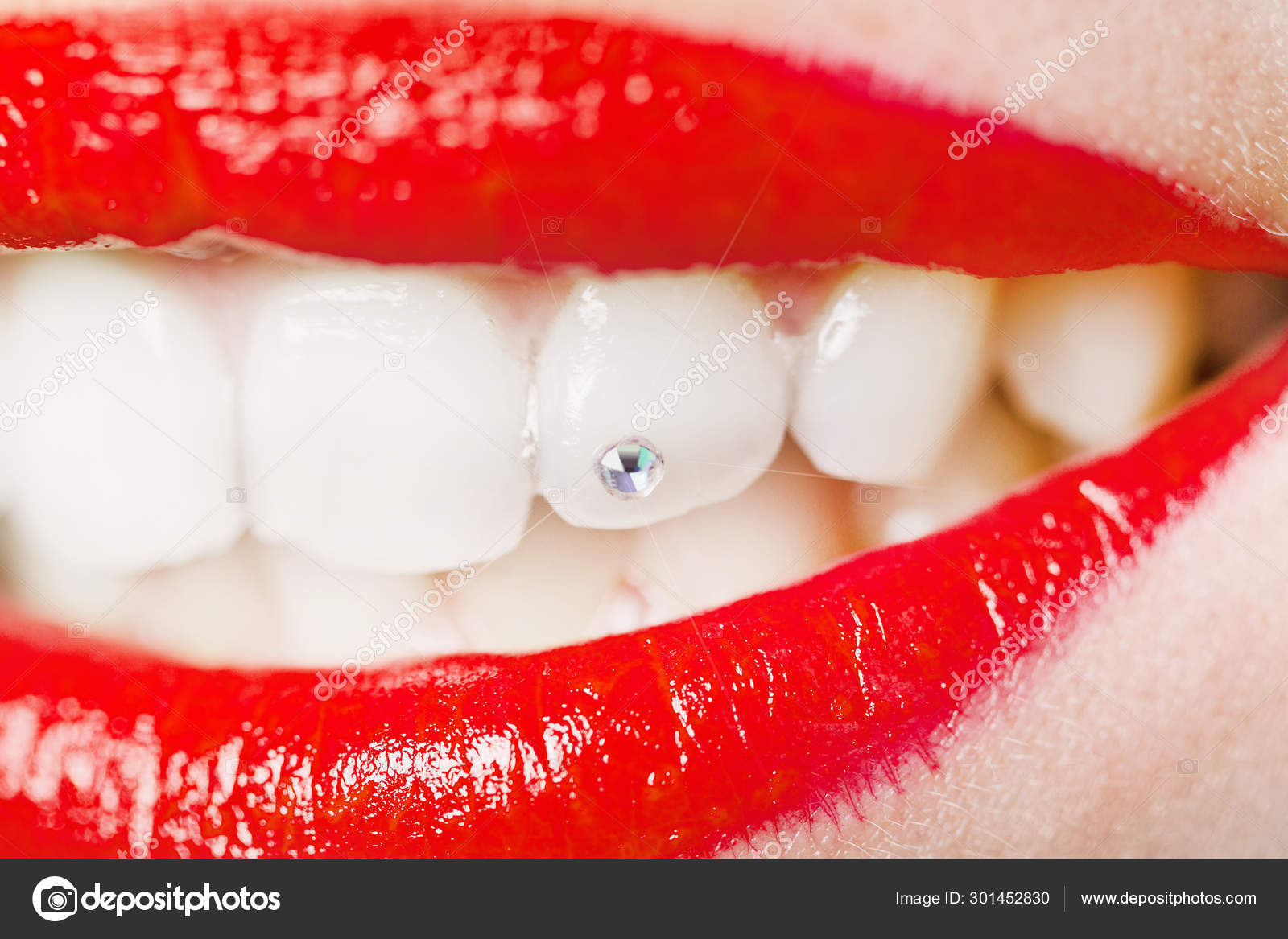 Сколько держатся скайсы на зубах. Сколько держатся скайсы на зубах. Сколько держатся скайсы на зубах. Сколько держатся скайсы на зубах. Скайсы на зубы бабочка.